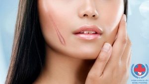 Nấm da có để lại sẹo hay không cùng tìm hiểu
