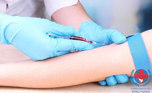 Cần xét nghiệm máu chẩn đoán 