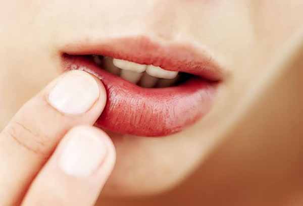 5 Cách chữa bệnh nấm miệng nên biết!